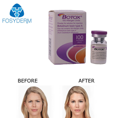 Allergan Botox Injectie 100 eenheden voor rimpelverwijdering