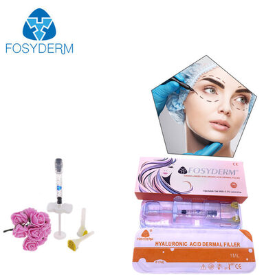 2 ml Lip Filler Injection Hyaluronzuur Dermaal Filler Injecteerbaar voor Lip Vergroting Gel