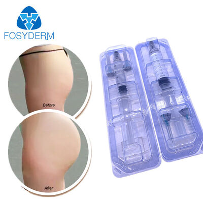 Fosyderm Cross-Linked Hyaluronic Acid Dermal Filler for Plastic Surgery
