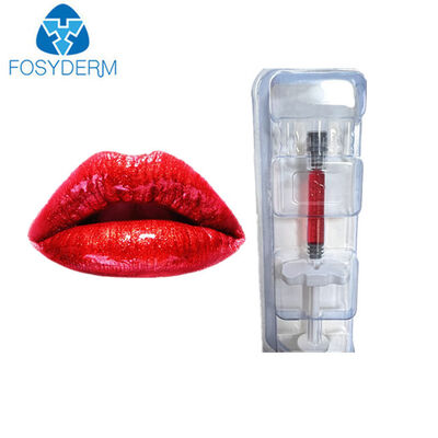 Rode lippen Lipverbetering Hyaluronzuurvuller Korea huidvuller