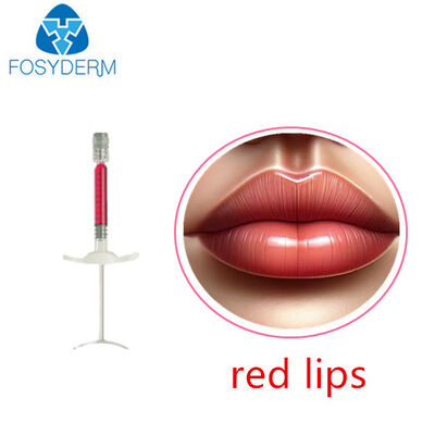 Lipvolume met vitamine B12 1 ml 24 mg / ml dermale vuller Hyaluronzuur Rode lippenvuller