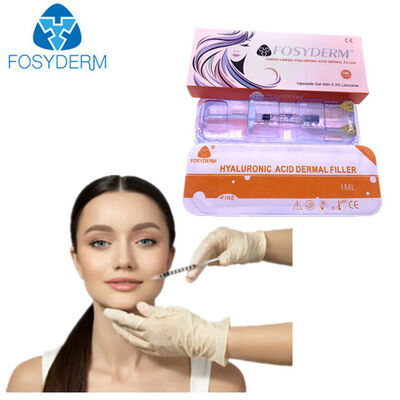 Deep Line Anti-rimpel gezichtsvuller Injecteerbare hyaluronzuur dermale lipvuller