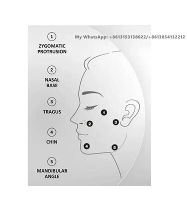 Profhilo 64mg/2ml Hyaluronzuur Huidvuller Injectie Huidverzorging
