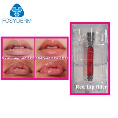 Rode Lip Filler met Vitamine B12 Injectie Hyaluronzuur Filler Beauty Lipvergroting 1 ml