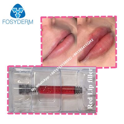 Red Lip Filler With Vitamin B12 Hyaluronic Acid Filler Gel For Lips