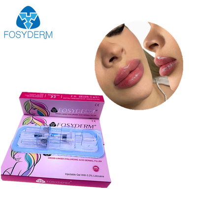 Fosyderm Filler Hyaluronzuur Dermale Filler Injectie voor lippen 2ml