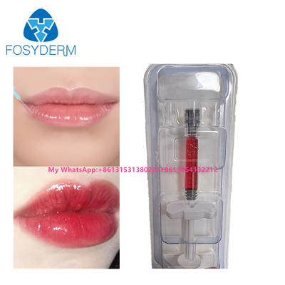 Hyaluronzuur huidfiller injectie met vitamine B12 voor lippen 1 ml