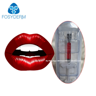 Hyaluronzuur huidfiller injectie met vitamine B12 voor lippen 1 ml
