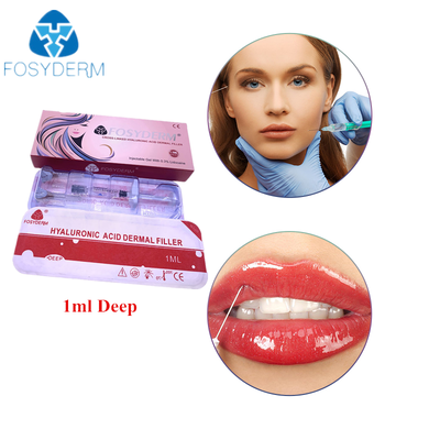 Cross-linked hyaluronzuur huidvuller anti-rimpel lipvergroting