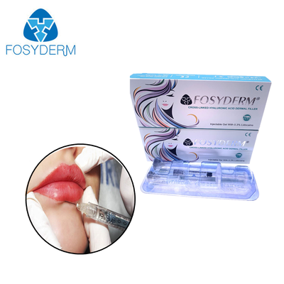 1ml 2ml Hyaluronzuur Huidvuller Anti-rimpel Lipvergroting 24mg