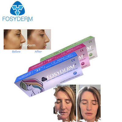 Hyaluronic Acid Dermal Filler Anti Wrinkles Nose Up Lips Augmentation