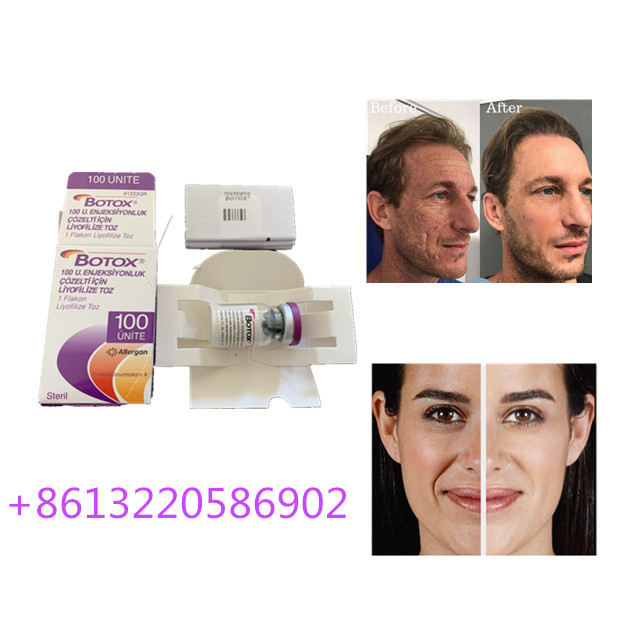 Anti het Verouderen Allergan  Injectie100units Type A Antirimpel