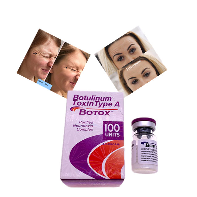 Het Type van de Allergan Botulinum Toxine A  Hyaluronic Zuur van de 100 Eenheids het Huidvuller