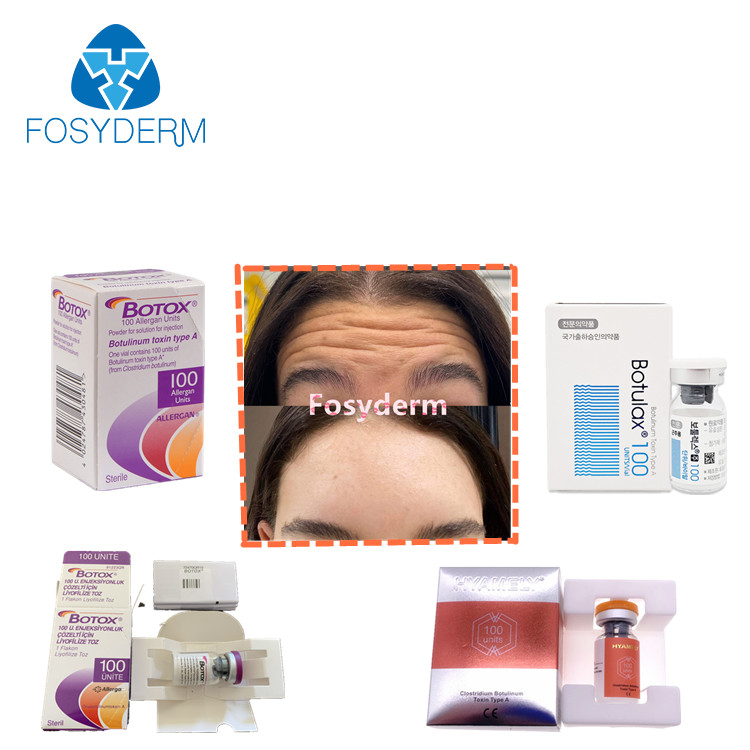 van de de Toxineinjectie van 100units TypeA Botulinum Antirimpels  Allergan