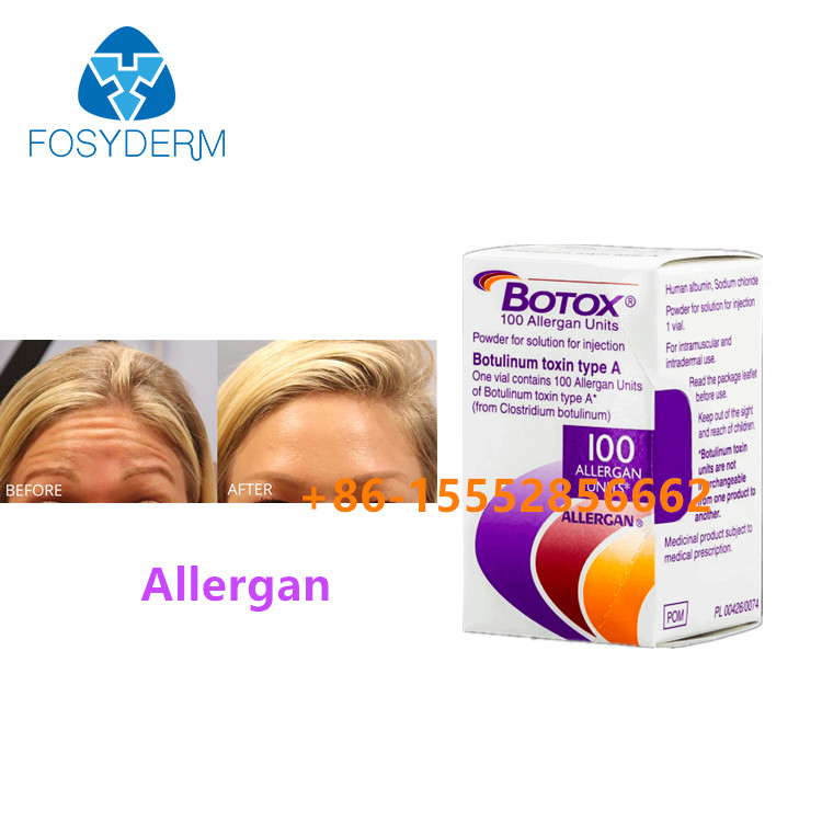100 eenheden Botulinum Toxin Allergan Wegnemen Gezichtsrimpels Injectie  Type A