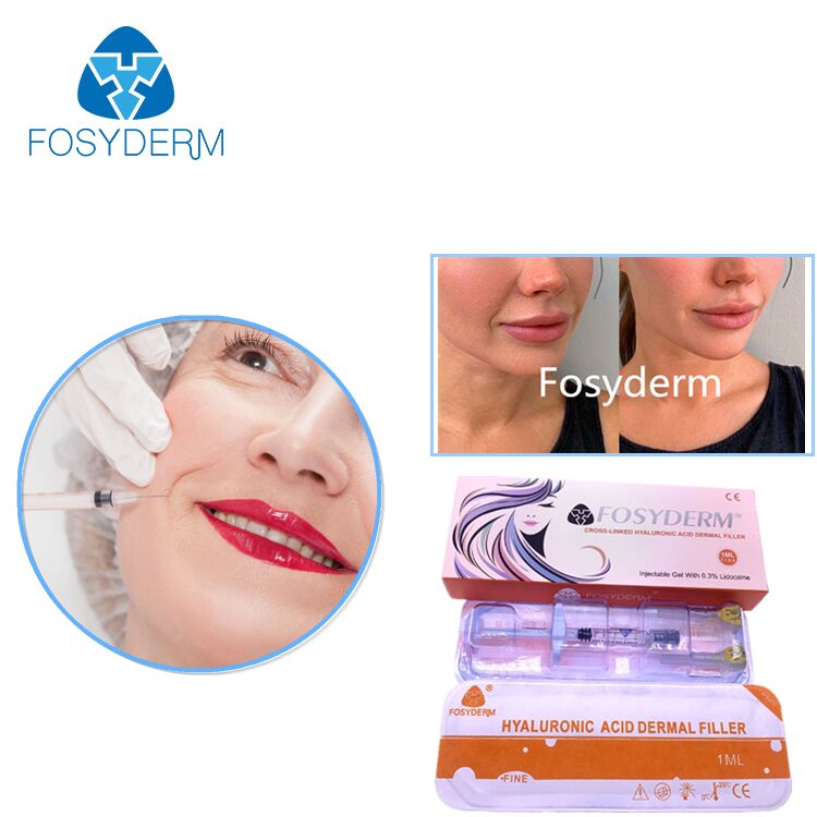 2 ml Lip Filler Injection Hyaluronzuur Dermaal Filler Injecteerbaar voor Lip Vergroting Gel