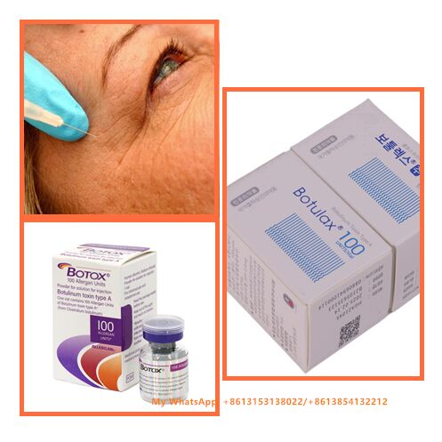 Beste Effecten Gezichtsrimpels Verwijdering Botuline Toxine Allergan Botox 100 Eenheden