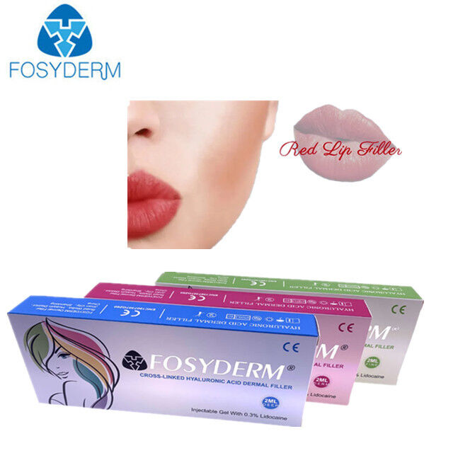 1ml 2ml Hyaluronzuur Huidvuller Anti-rimpel Lipvergroting 24mg