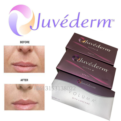 Langdurige Ultra3 Ultra4 Voluma Injectie van de Juvederm Hyaluronic Zure Gezichtsvuller