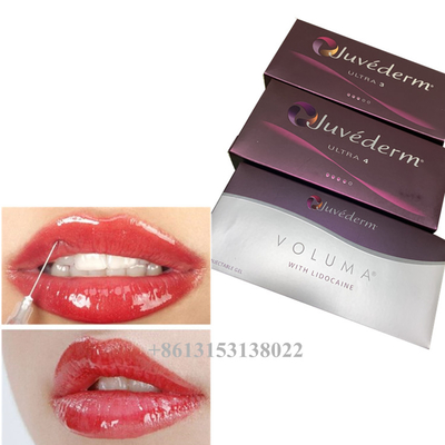 Juvederm Voluma Hyaluronzuur Dermale Filler Gel 24mg/Ml Dermale fillers