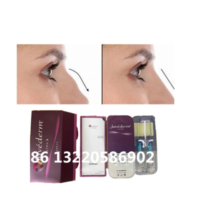 De Vuller Hyaluronic Zure Huid van de Juvedermultra3 Ultra4 Voluma Neus