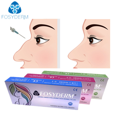 Hyaluronic Zure Huidinjectie 1ml 2ml van de Neusvuller voor het Vrouwelijke Gebruiken