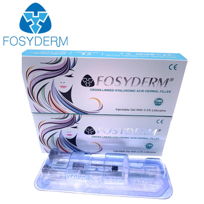 Gezicht en van Lippenfosyderm 1ml Derm Vuller die Rimpels verwijdert