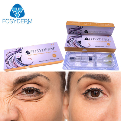 5ml Hyaluronic Zure Huid de Vullerinjectie van Fosyderm voor Lippenneus