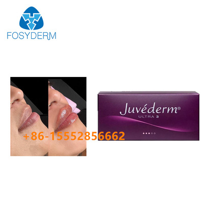 Van de Vullerjuvederm 2ml van de lippenverhoging de Huid Hyaluronic Zure Injectie