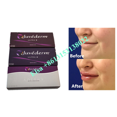 Voluma Hyaluronzuur Fosyderm Dermal Filler Injectie 24mg/Ml