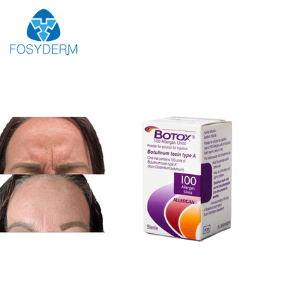 Anti Rimpels  De Allergan 100 Eenheden Injectie