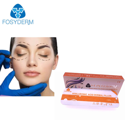 Langdurige Fosyderm hyaluronzuur huidvuller voor cosmetische injectie