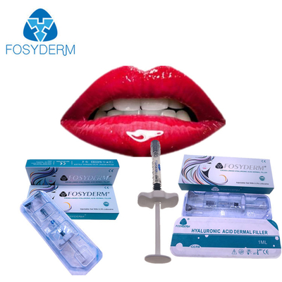 De Vullerinjectie Fosyderm 1ml Derm van lippen Molligere Ha