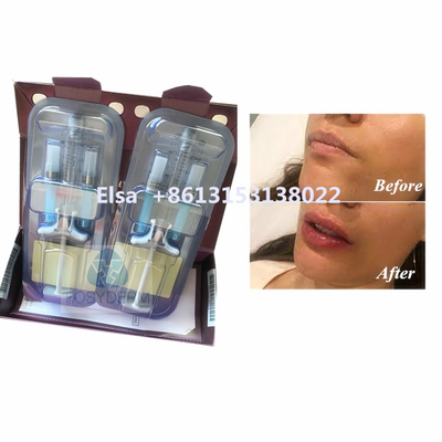 Schoonheidsproduct Juvederm Voluma Hyaluronzuur Gezichtsvuller HA Injectie