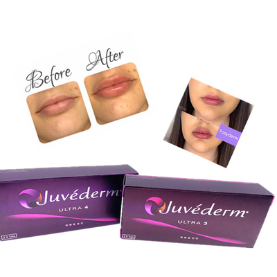 Het Hyaluronic Zure Huid van de de Lippenvuller van Juvederm van de Gelinjectie Anti Verouderen 2ml van Ce