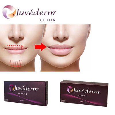 Juvederm Ultra3 Hyaluronzuur Filler voor lippen Dermale injectie gel voorgevuld
