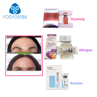 100 Eenheden Type A Botulinum van de Rimpels Botulax van Toxineallergan Anti Gezichtsinjectie