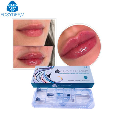 Injectie van de Rimpels Huidvullers van het Fosyderm Hyaluronic Zure Gel Anti Gezichts