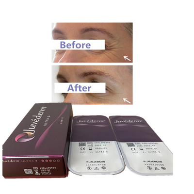 De Lippenvuller 24mg van de Juvederm2ml Ultra3 Ultra4 Voluma Hyaluronic Zure Huidvuller