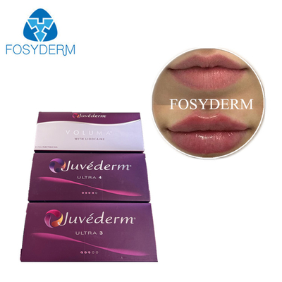 Juvederm Dermal Filler Injection Cross Linked Hyaluronic Acid HA Gel Gezicht Filler Voorgevulde Spuit