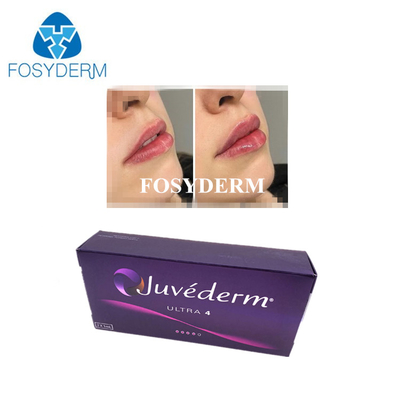 Koreaanse Hyaluronic Acid Cross Linked Dermal Filler Juvederm Lip Filler Injecties