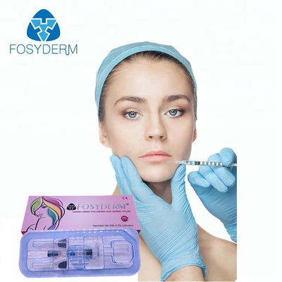 Lip Filler Lip Volheid Vergroting 2 ml Dermale Filler Fosyderm HA Filler Injectie