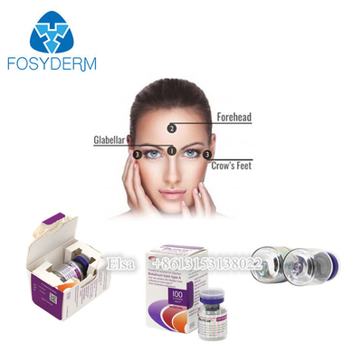 Verwijder rimpels  Botulax 100 eenheden Botulinum Toxin Injectie voor anti-aging