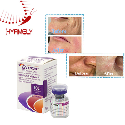 Rimpelverwijdering Allergeen Botulinum Toxin Type A 100 Eenheden