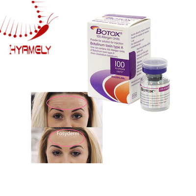 Anti-rimpel esthetica gevriesdroogde meditoxine allergeen poeder botulinumtoxine