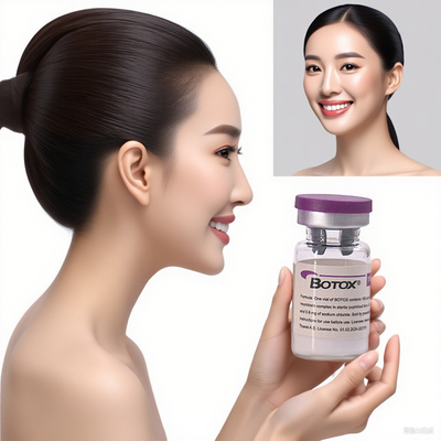 Allergan Injection Botulinum Toxin Anti Wrinkle Dermal Filler voor gezicht en nek