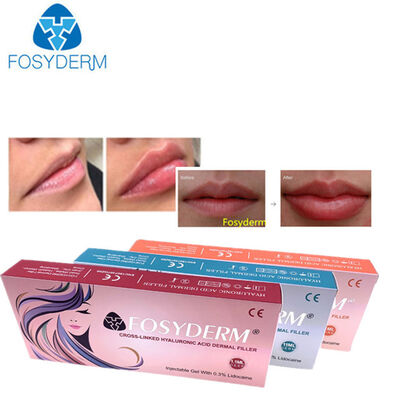 Cross Linked Gel Hyaluronic Acid Dermal Filler Cheek Plumping Injections 2.0ml