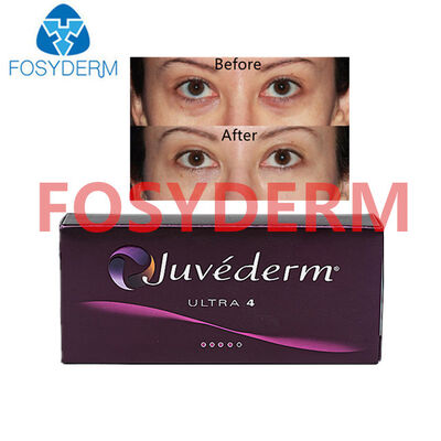 Juvederm Hyaluronzuur Huidvuller voor Lip & Gezichtslift 24mg