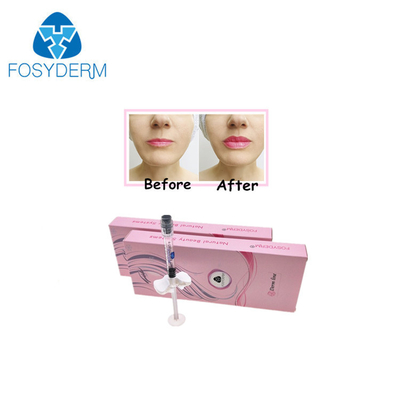Van de Kin de Volheid Crosslinked Ha van de lippenneus Hyaluronic Zure Injecteerbare Vuller 24mg/Ml