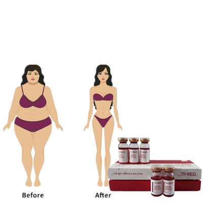 De meso Rode Lipo Losse Lipolytic Mesotherapy Injectie van Lipo